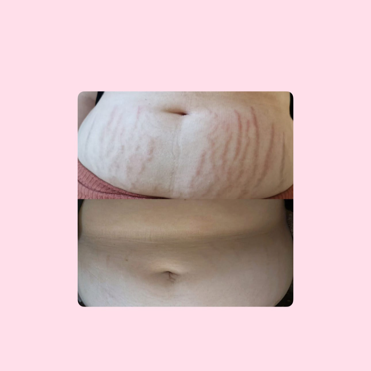 Crema Aclarante rosa mosqueta